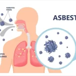 mesothelioma-cancer-bioinformatics