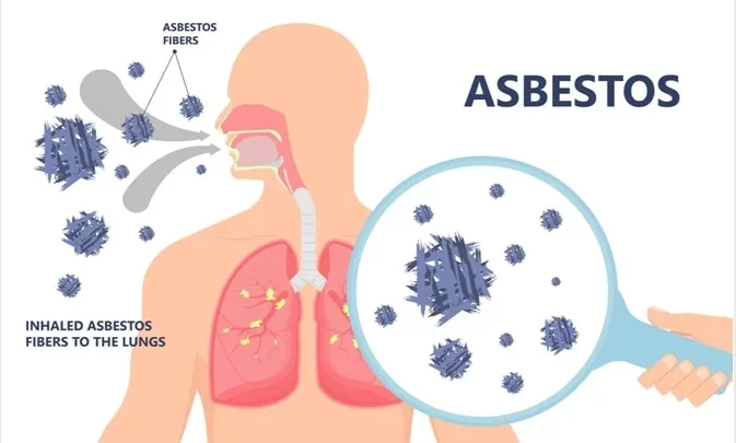 mesothelioma-cancer-bioinformatics